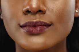 causes treatment of dark lips dr