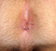 Close up of anus