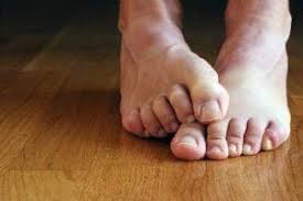 athlete s foot foot and ankle clinic