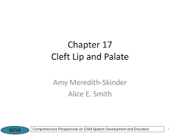 ppt chapter 17 cleft lip and palate