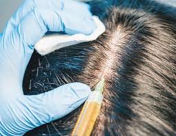 women s hair follicle regeneration ht