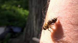 How to treat a bee sting. Would You Help A Bee Survive After It Stung You Outrageous Acts Of Science Youtube