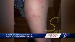 If you have fever, cough, shortness of breath, or any of the other symptoms listed above, please call your healthcare provider. This Is Also Covid Woman Says Her 8 Year Old Tested Positive For Covid 19 Displayed Unusual Symptoms
