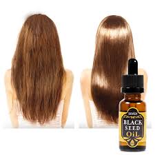 Hair regrowth (seen in the image above) was found in 33% of the mice in the experimental group (group a). Sevich Natural Black Seed Oil Hair Care 20ml Moisturize Hair Oil Repair Daed Hair Help Hair Loss Hair Regrowth Hair Scalp Treatments Aliexpress