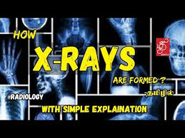 Maybe you would like to learn more about one of these? How X Rays Are Formed X Ray Basics X Ray In Tamil X Ray Tube Tamildentico Xray Youtube