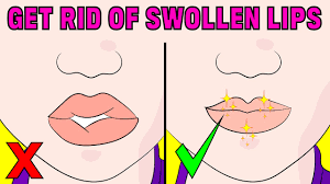 how to fix swollen lips naturally you