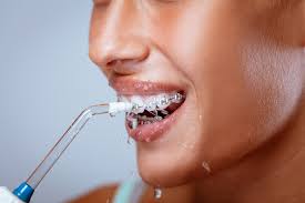 is it safe to use a waterpik for braces