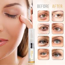 instant eyebag remover anti aging