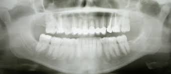cbct dental imaging market in u s