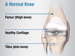 total knee replacement surgery meril life