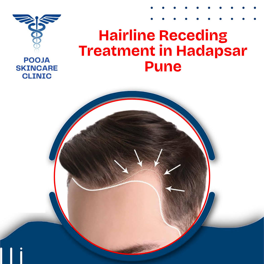 Hairline Receding Treatment in Hadapsar Pune product image