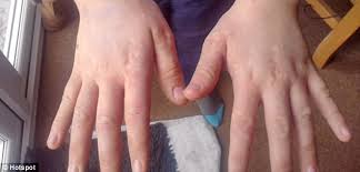 Image result for pictures of children with cold hands