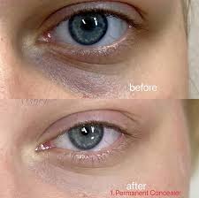 permanent concealer tattoo the