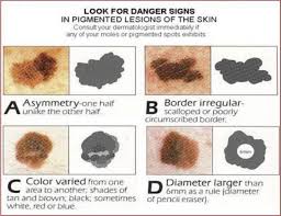 symptoms of skin cancer on my feet