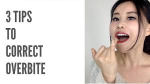 Overbite mainly occurs due to three reasons. 3 Tips To Correct Overbite Tongue Posture Don T Bite Nails And Chew On The Back Teeth Youtube