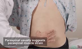 What is the lower back and why does it hurt? Low Back Exam Approach To Stanford Medicine 25 Stanford Medicine