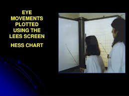 Ppt An Overview Of The Orthoptist Practical Demonstration