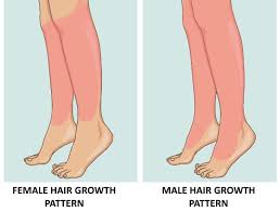 It can have the opposite effect on male scalp hair, causing it to thin. A Guide To Excess Hair Growth In Women