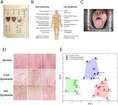 A An Ancient Instruction For Tongue Diagnosis Recorded In