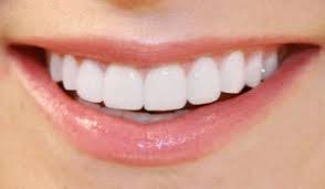 You have to imitate the veneering machines. Are Porcelain Veneers Right For You Ask Yourself These Questions To Find Out Allred Dental
