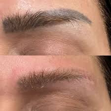 permanent eyebrow removal browns co