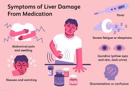 liver failure causes symptoms