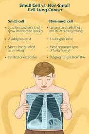 small cell vs non small cell lung cancer