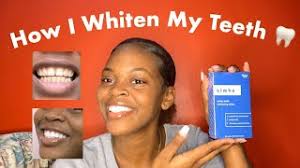 Our whitening strips have been designed to whiten your teeth quickly in just 30 minutes, but they can be left on for up to 60 minutes if desired. Zimba Teeth Whitening Strips 2 Weeks Update Youtube