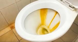 Remove Yellow Stain In Toilet Bowl
