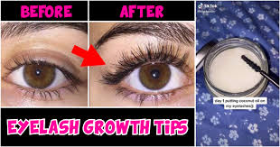 natural eyelash growth