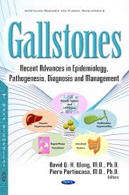 Gallstones Recent Advances In Epidemiology Pathogenesis Diagnosis And Management