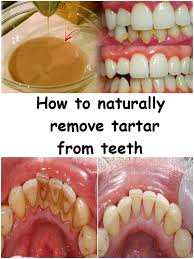 To get started, first combine both your salt and baking soda in a small container. How To Remove Braces At Home Arxiusarquitectura