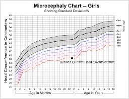 Microcephaly Head Circumference Chart Head Circumference