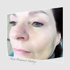 after pictures anew permanent makeup
