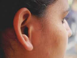 smell behind ears causes symptoms and