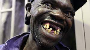 What follows is a list of the 10 ugliest people in the world. Zimbabwe S Mr Ugly Contest Winner Too Handsome Bbc News