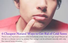 rid off painful cold sores naturally