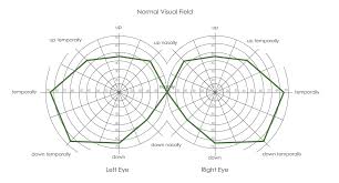29 Eye Catching Field Of Vision Chart