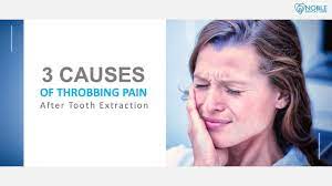 throbbing pain after tooth extraction
