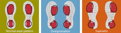 where-do-your-shoes-wear-if-you-overpronate
