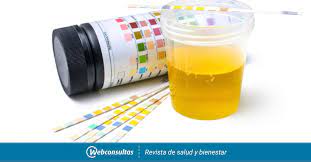 Color, aspecto, olor • análisis químico: Analisis De Orina Que Es Y Cuando Se Realiza Pruebas Medicas