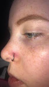 Leave your piercing in your nose even if it's infected. How To Get Rid Of The Bump Next To My Nose Ring Quora