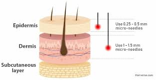 If it is your first time to try microneedling, you can start by doing it 2 times in your first month. Dermaroller For Hair Loss An In Depth Guide Hairverse