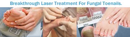 laser treatment for fungus toenails