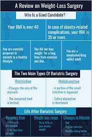 ultimate guide to bariatric surgery