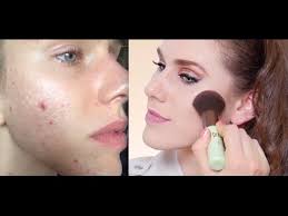 acne makeup coverage makeup tips for