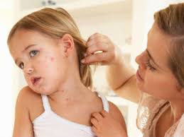 10 common rashes on kids with photos
