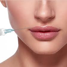 juvederm ultra plus xc 1cc syringe