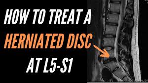 how a herniated disc at l5 s1 is treated