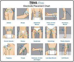 Tens Unit